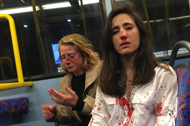 Lesbian couple attacked on bus gets blasted on social media ‘for being gay’
